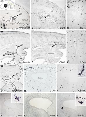 Characterization and ontogeny of a novel lymphoid follicle inducer cell during development of the bursa of Fabricius